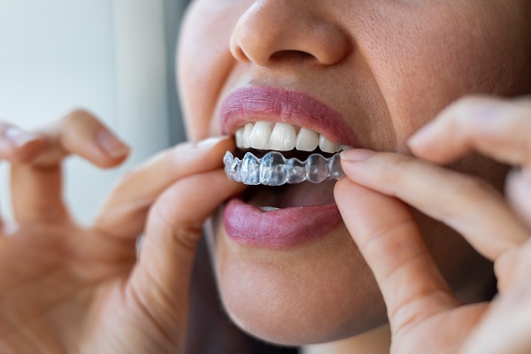 Do Clear Aligners Hurt?