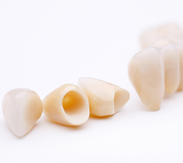 Sandston Dental Crowns and Dental Bridges