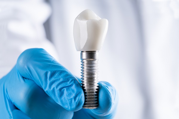 Reasons To Consider Dental Implants To Replace Multiple Missing Teeth