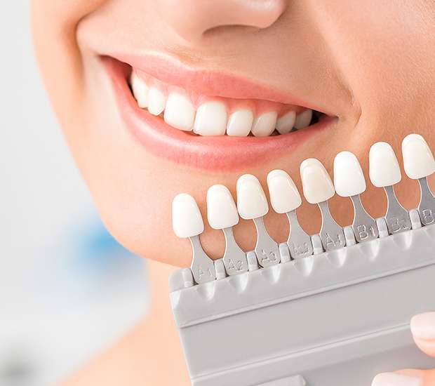 Shaping your smile: the pros and cons of tooth contouring - Richmond Dental